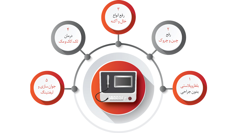 دستگاه پلاسما فایربولت